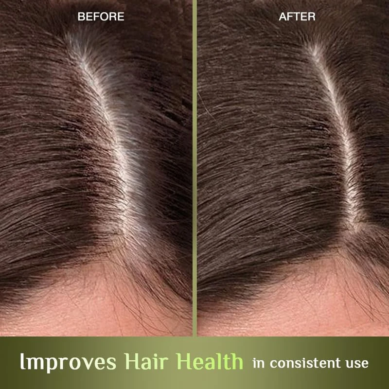 Richfeel Hair Nourisher Oil| For Hair Fall Control | Hair Growth Treatment | Trichologist Developed Formula | High Concentration |10 ml - Thumbnail 6