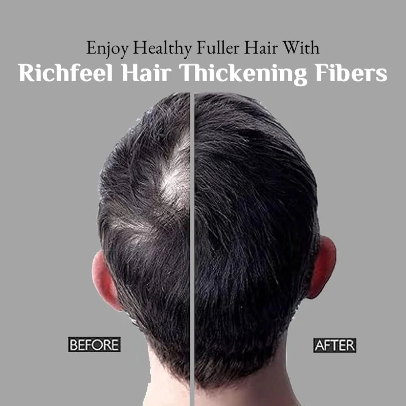 Richfeel Hair Thickening Fibers (Black 28gm) | Hair Fiber For Thin &amp; Fine Hair | Hair Building Fiber Black For Men &amp; Women (Pack of 1) - Thumbnail 8