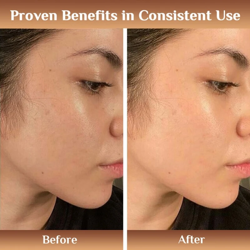 Richfeel Skin Brightening Day Serum 25ML thumbnail 7